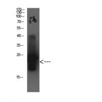 Cystatin C Mouse Monoclonal Antibody5A2