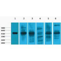 Cytokeratin 18 Monoclonal Antibody8F2