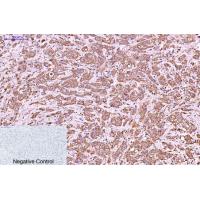 Cytokeratin 6 Monoclonal Antibody4A1