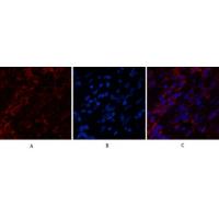 Cytokeratin 6 Monoclonal Antibody4A1