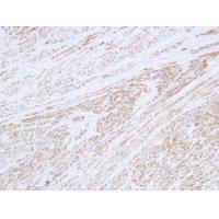 Desmin Monoclonal Antibody PT0121