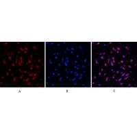 Desmin Monoclonal Antibody1B12