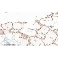 Desmin Monoclonal Antibody1B12