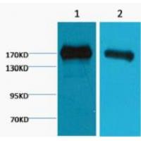 EGFR Monoclonal AntibodyM6