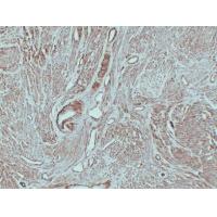 Caldesmon 1C1 mouse Monoclonal Antibody