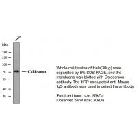 Caldesmon 1C1 mouse Monoclonal Antibody