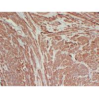 Calponin-1 1D1 mouse Monoclonal Antibody