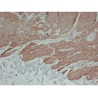 Calponin-1 1D1 mouse Monoclonal Antibody