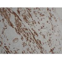 Calponin-1 1D1 mouse Monoclonal Antibody