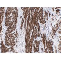 Calponin-1 1D1 mouse Monoclonal Antibody