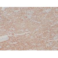 Calretinin Monoclonal Antibody PT0014