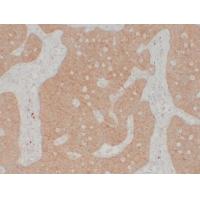 Calretinin Monoclonal Antibody PT0014