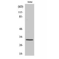 Carcinoembryonic Antigen Monoclonal Antibody10E1