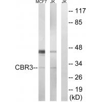 Carcinoembryonic Antigen Monoclonal Antibody10E1