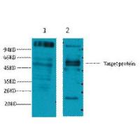 CD23 Monoclonal Antibody10H2