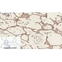 CD23 Monoclonal Antibody1E9