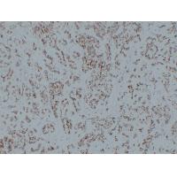 CD31 Mouse Monoclonal AntibodyPT0034