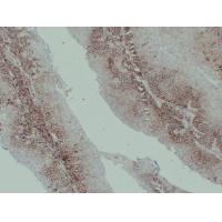 CD44 Monoclonal Antibody PT0046