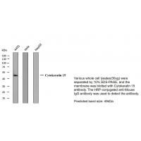 CK-15 5A1 mouse Monoclonal Antibody