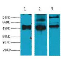 CK-17 Monoclonal Antibody10A1