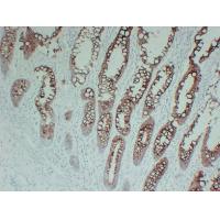 CK-20 5G1 mouse Monoclonal Antibody