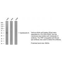 CK-6 Monoclonal Antibody PT0091