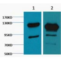 Cleaved PARP Monoclonal AntibodyM4