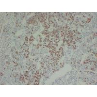 Growth HormoneGH Monoclonal Antibody PT0148