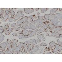 hCG β Monoclonal Antibody PT0149