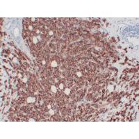 HER2/erbB-2 Monoclonal Antibody PT0151