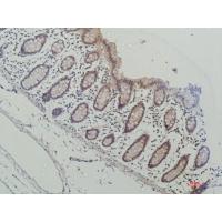 Galectin-3 Monoclonal Antibody16E6