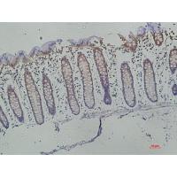 Galectin-3 Monoclonal Antibody6B8