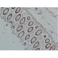 HSP90-α Monoclonal Antibody7D6