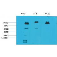 STAT3 Monoclonal Antibody1E3