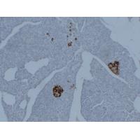 Synaptophysin 2D2 Monoclonal Antibody