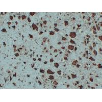 TRAP Monoclonal Antibody PT0248