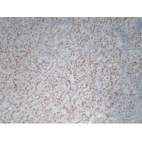 WT1 Mouse Monoclonal AntibodyPT0264