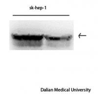 Vimentin Monoclonal Antibody1A7