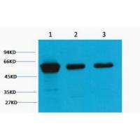 Vimentin Monoclonal Antibody1A7