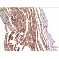 VE-Cadherin Mouse Monoclonal Antibody8E5