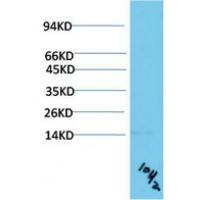 TTR Mouse Monoclonal Antibody10H2