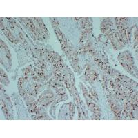 Topoisomerase IIa, CONFIRM Monoclonal Antibody PT0247