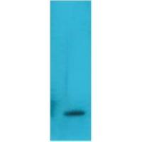 TNF α Monoclonal AntibodyQ36