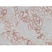 pVHL Mouse Monoclonal AntibodyPT0230