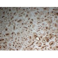 PSMA 2A2 mouse Monoclonal Antibody