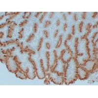 MUC5AC Monoclonal Antibody PT0176