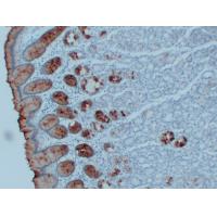 MUC5AC Monoclonal Antibody PT0176