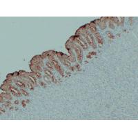 MUC5AC Monoclonal Antibody PT0176