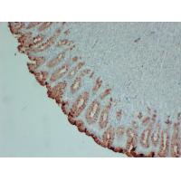 MUC5AC Monoclonal Antibody PT0176