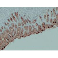 MUC5AC Monoclonal Antibody PT0176